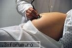 sarcina si nasterea sunt fenomene naturale, nu sunt o boala. va puteti continua cu succes